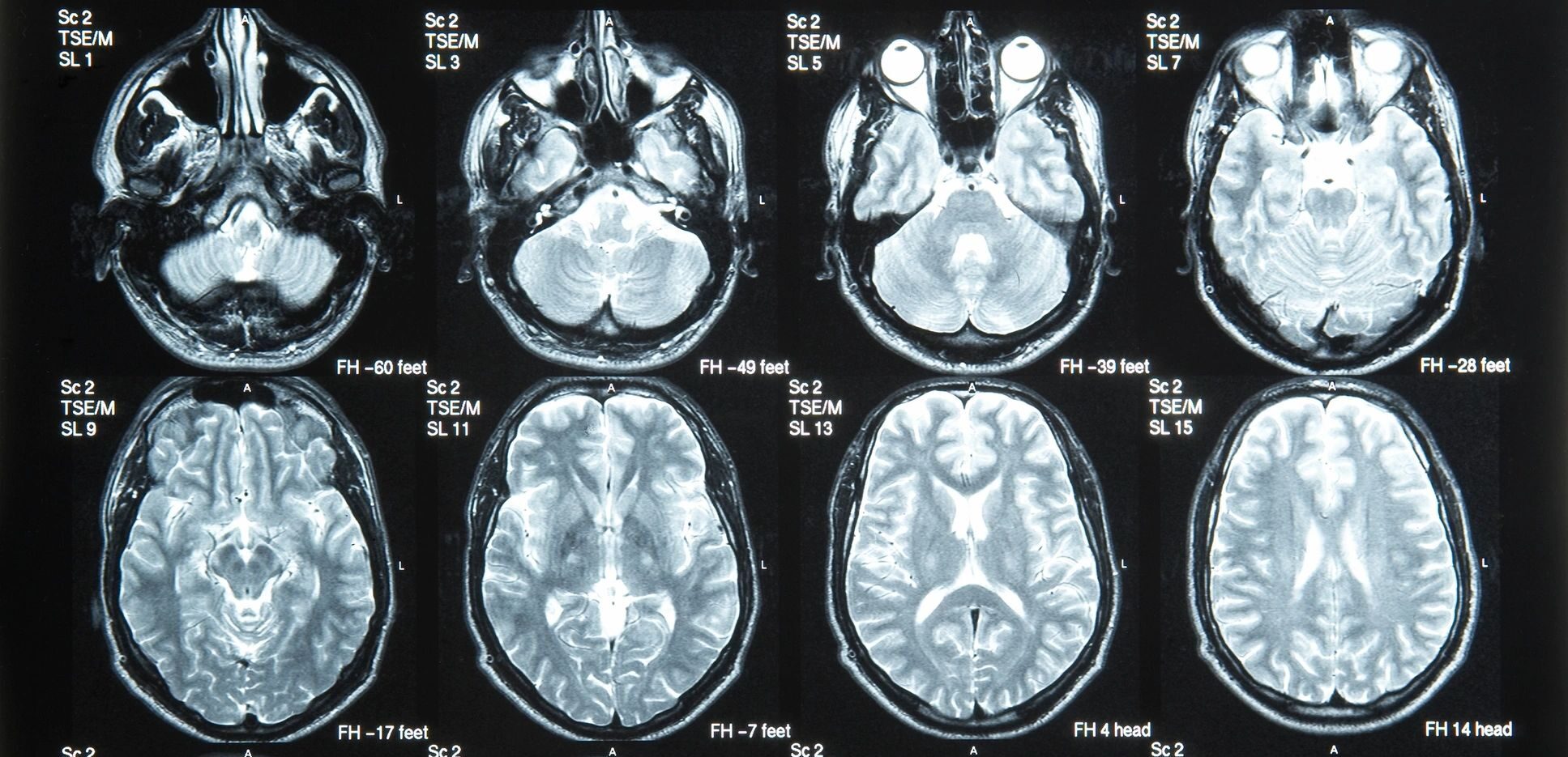 The Brain’s Response to Childhood Trauma and How to Heal Through Positive Relationships